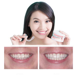 Cosmetic dental treatments: straighten your teeth with nearly invisible  braces - Mississauga Dentist & Dental Office - Jauhal Dental